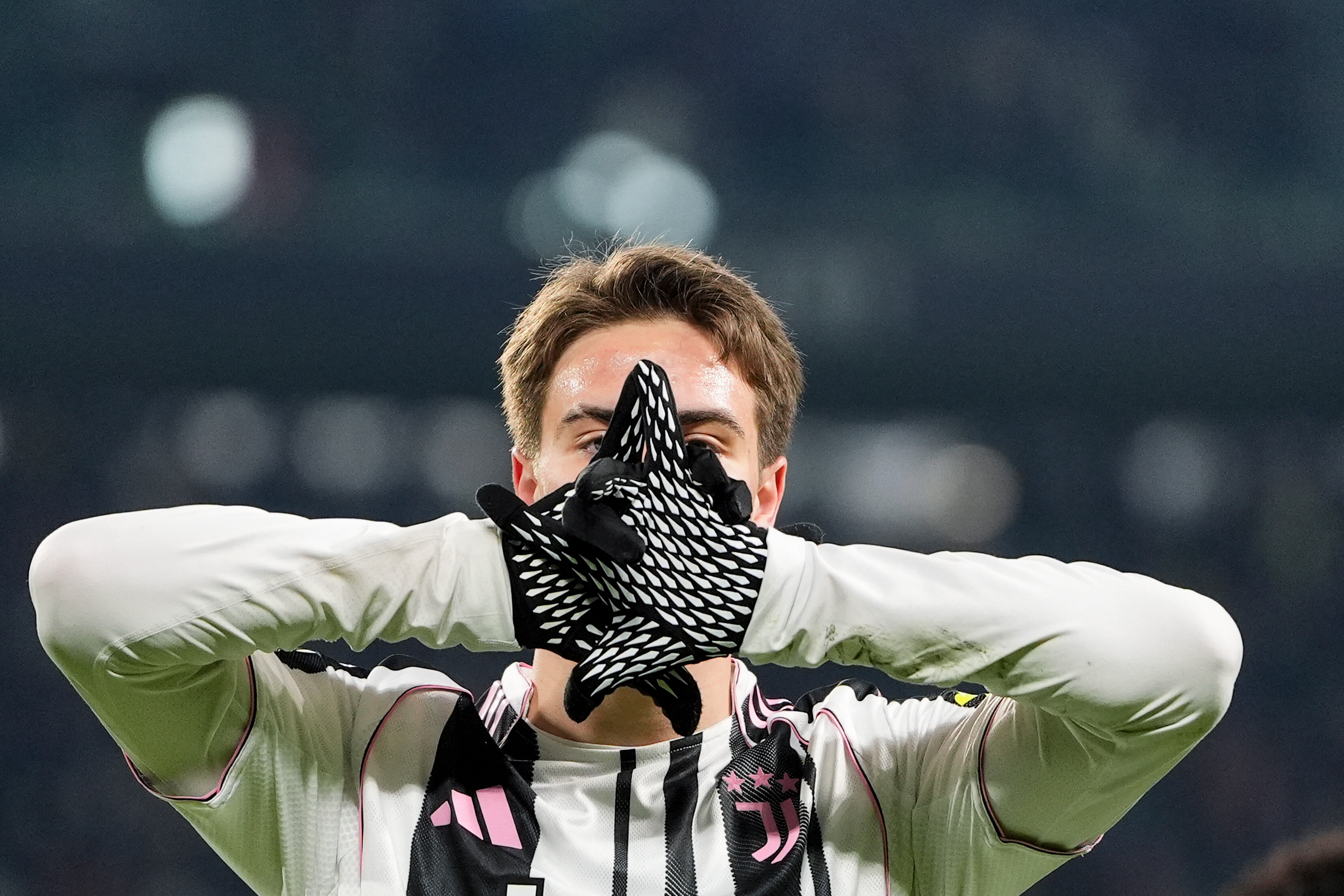 包含赛后罗马备战法甲尤文图斯清晨伤情更新，尼斯围绕社区盾战术微调瞬间刷屏的词条